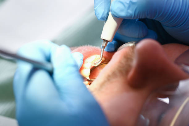 Best Chipped Tooth Repair Near Me  in River Road, WA